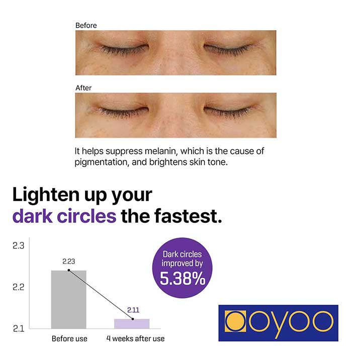 کاهش چین و چروک و خطوط ریز با کرم دور چشم سام بای می