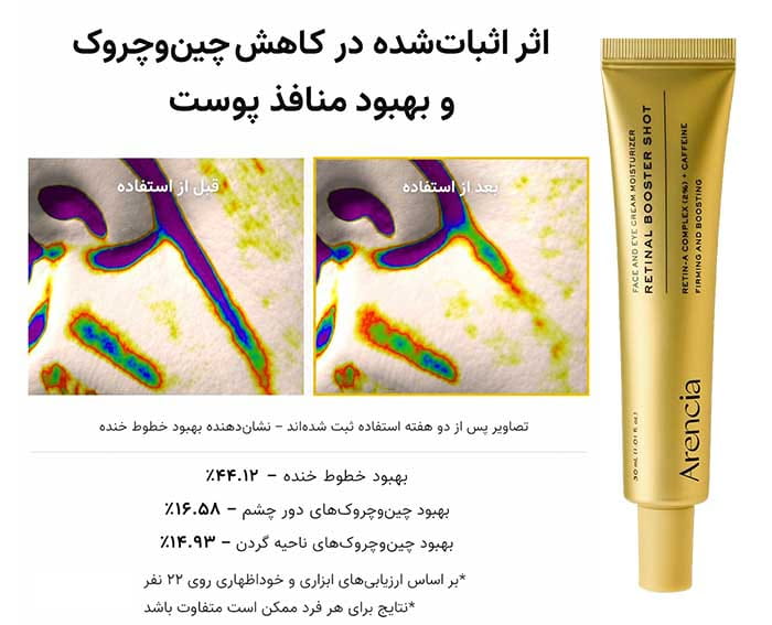 نمودار و نتایج بالینی کاهش چین و چروک با سرم رتینال آرنسیا پس از دو هفته