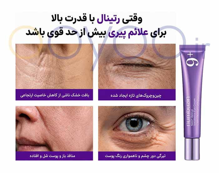 علائم پیری پوست و مشکلات پوست اطراف چشم