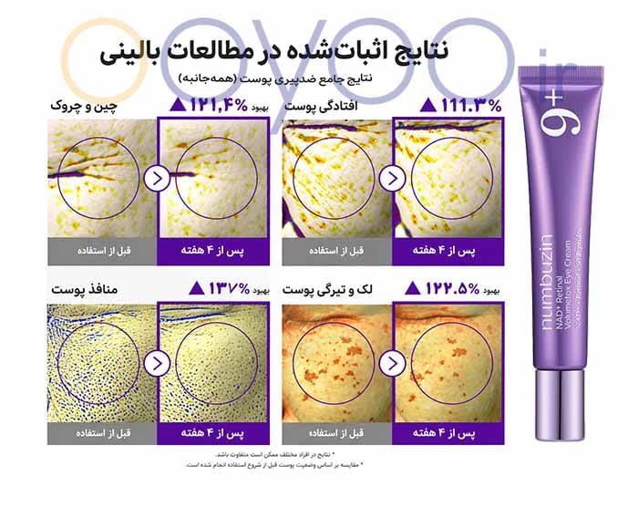 نتایج بالینی کرم دور چشم نامبوزین شماره ۹ پس از چهار هفته