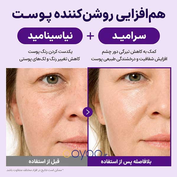 نیاسینامید و سرامید در کرم دور چشم نامبوزین شماره ۹